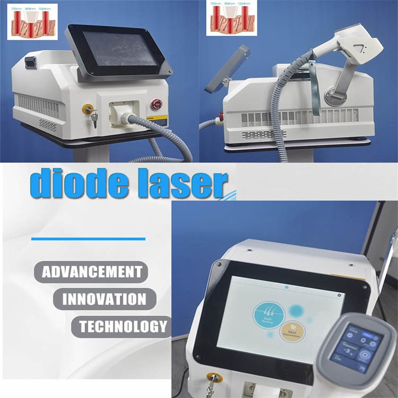 2021 hot sale diode laser 755 808 1064 Newest diode laser hair removal machine / 808nm diode laser hair removal