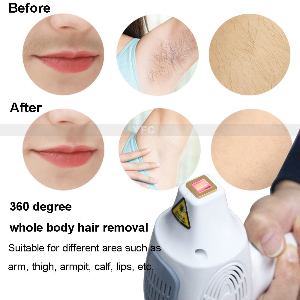 808nm Diode Laser Ice Hammer 2 in 1 Removal Machine Hair Remover New Homeuse Spa Salon Skin Care Beauty Device - Image 2