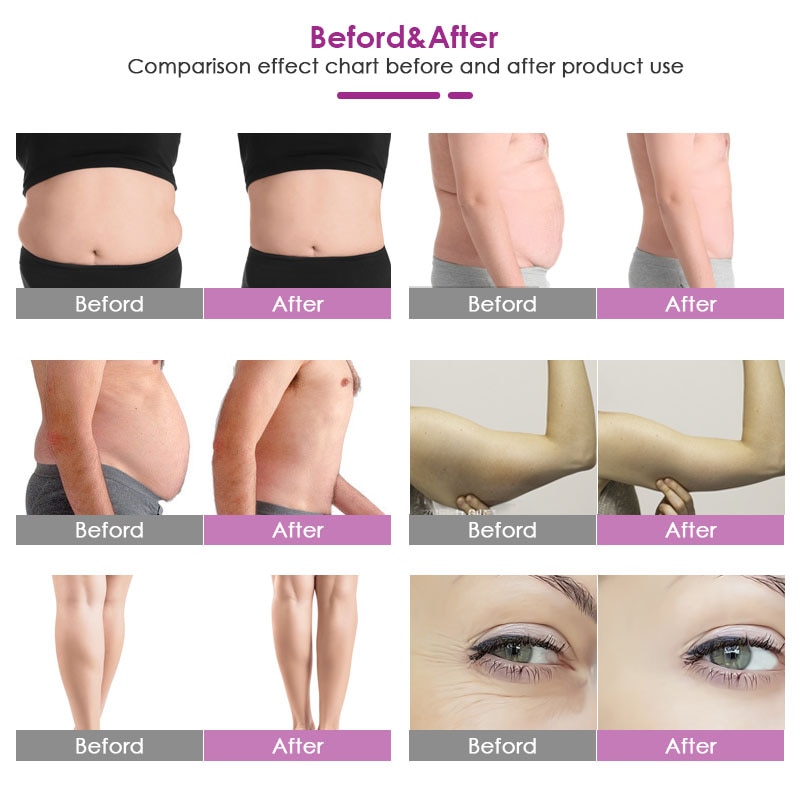 EU tax free new Lipolaser Fat Slimming Diode Lipo Laser Lipolysis Cellulite Weight Loss fast slim body shaping machine 6pads