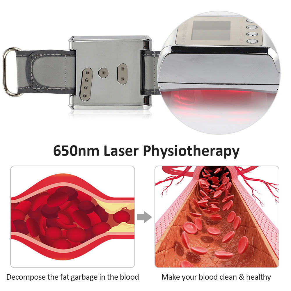 Household 650nm Laser Physiotherapy Wrist Diode LLLT for Diabetes Hypertension Treatment Diabetic Watch Laser Sinusitis Therapy - Image 4
