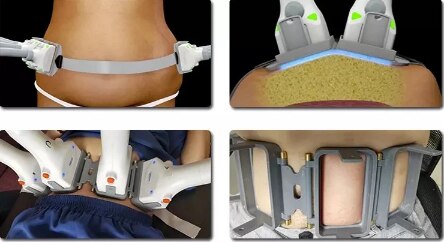 Professional 1060nm laser diode body shaping slimming machine 1060 laser diode cellulite treatment machine body contouring fat - Image 4