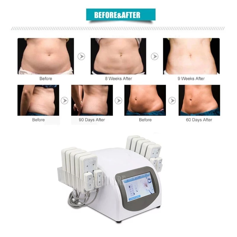 Professional Diode Lipolaser Slimming Lipo Laser Machine 14 Paddles 650nm Fat Burning Remover Body Shaping Weight Loss Apparatus - Image 5