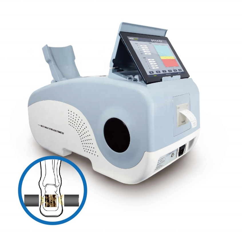 HJ3000 Medical Hospital Automatic Adjustable Portable Ultrasound Bone 